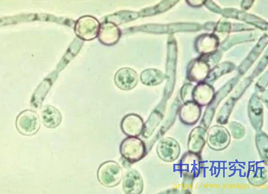 白色念珠菌檢測